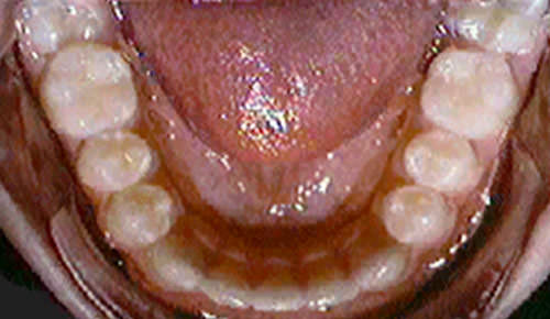 Atlas de ortodoncia viazis pdf editor download